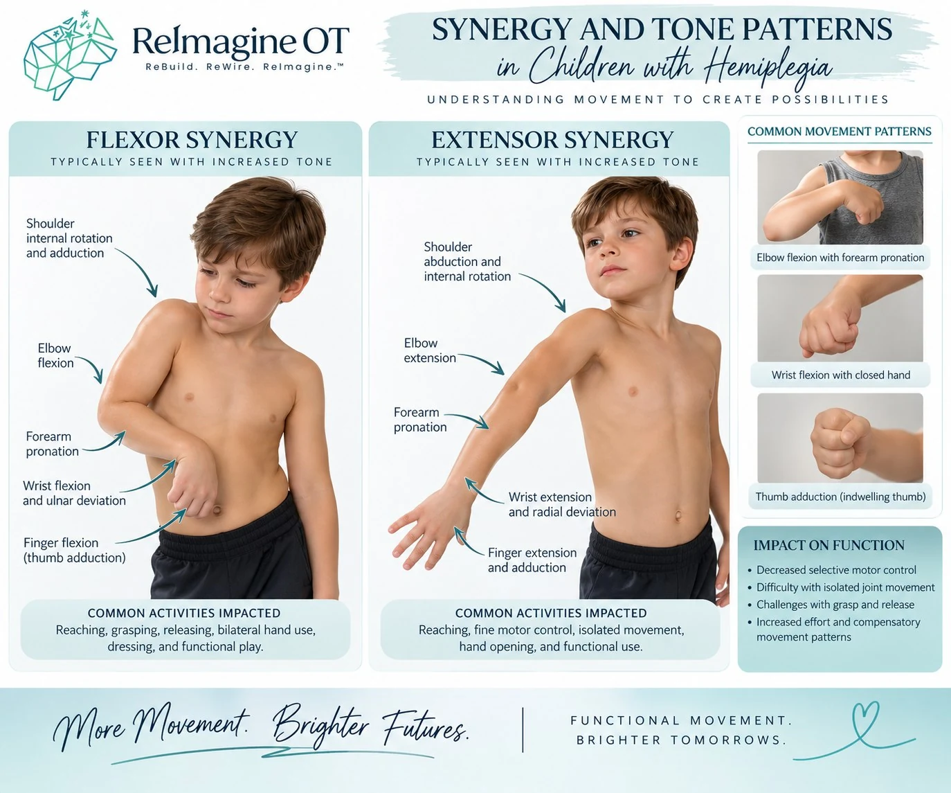 Synergy and tonal patterns in hemiplegia — one-sided flexor dominance, trunk shortening, compensations, and neglect of the affected side.